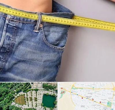 عمل لیپوماتیک در وکیل آباد مشهد