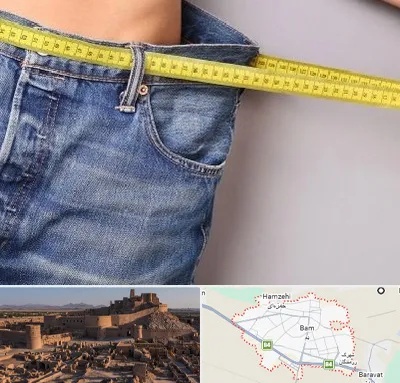 عمل لیپوماتیک در بم