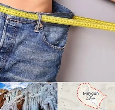 عمل لیپوماتیک در میگون