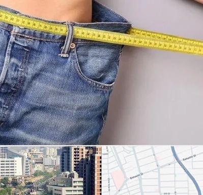 عمل لیپوماتیک در خیابان بهشتی