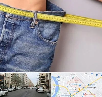 عمل لیپوماتیک در زیتون کارمندی اهواز