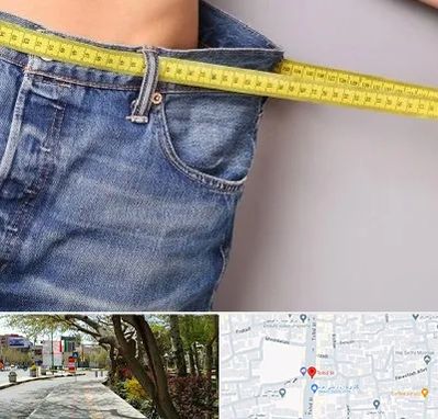 عمل لیپوماتیک در خیابان توحید اصفهان