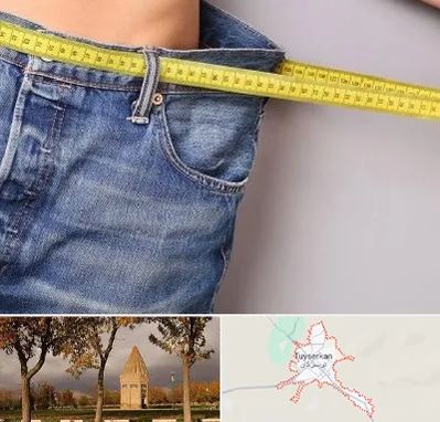 عمل لیپوماتیک در تویسرکان