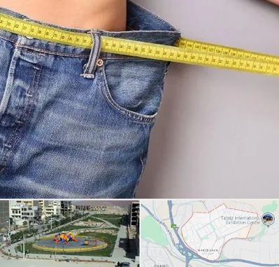 عمل لیپوماتیک در مرزداران تبریز