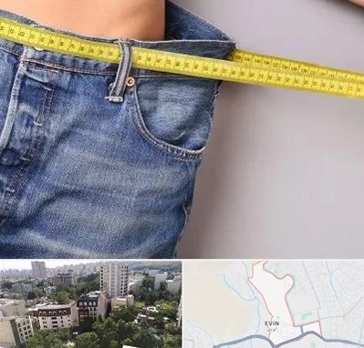 عمل لیپوماتیک در اوین