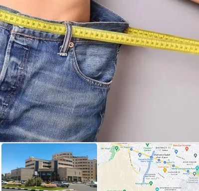 عمل لیپوماتیک در صیاد شیرازی مشهد