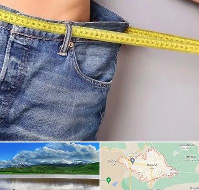 عمل لیپوماتیک در مرند