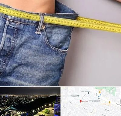 عمل لیپوماتیک در هفت تیر مشهد