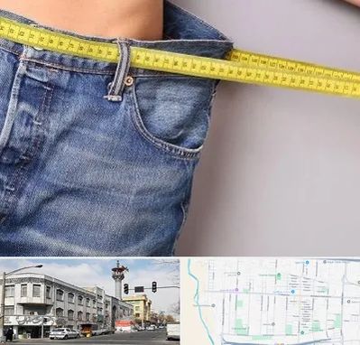 عمل لیپوماتیک در 17شهریور