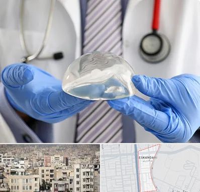 ماموپلاستی در اسکندری