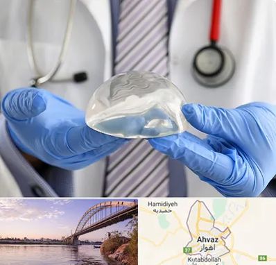 ماموپلاستی در اهواز