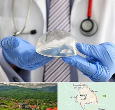 ماموپلاستی در آمل