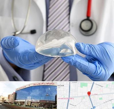 ماموپلاستی در نصف راه تبریز