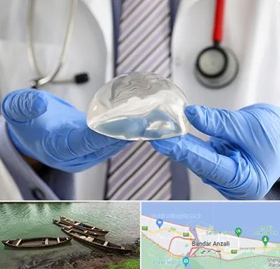 ماموپلاستی در بندر انزلی