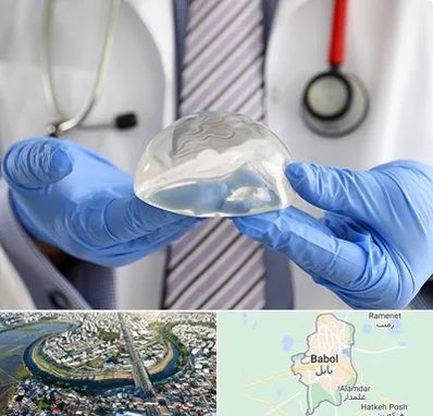 ماموپلاستی در بابل