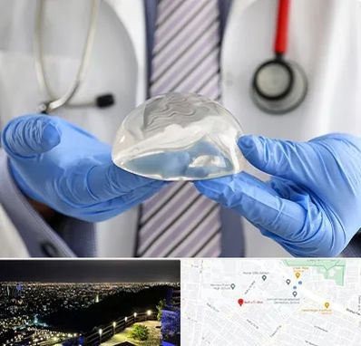 ماموپلاستی در هفت تیر مشهد