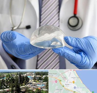 ماموپلاستی در رودسر