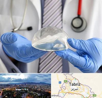 ماموپلاستی در تبریز