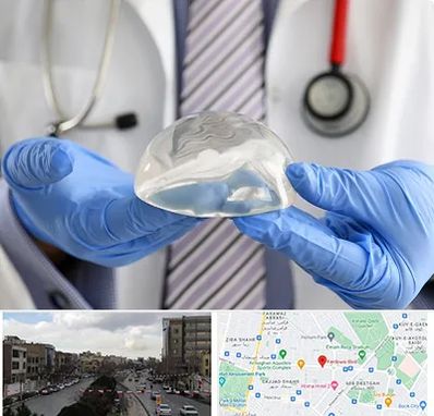 ماموپلاستی در بلوار فردوسی مشهد