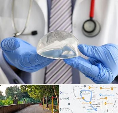 ماموپلاستی در بلوار گیلان رشت