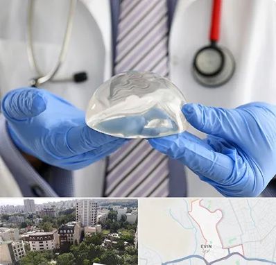 ماموپلاستی در اوین