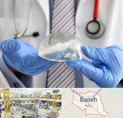 ماموپلاستی در بانه