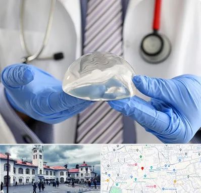 ماموپلاستی در میدان شهرداری رشت