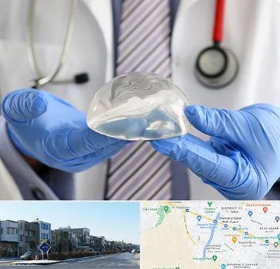 ماموپلاستی در شریعتی مشهد