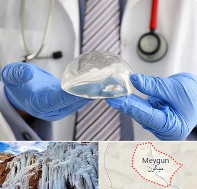 ماموپلاستی در میگون