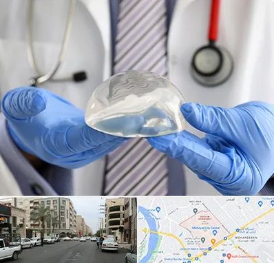 ماموپلاستی در زیتون کارمندی اهواز