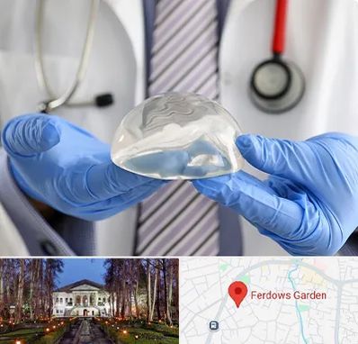 ماموپلاستی در باغ فردوس