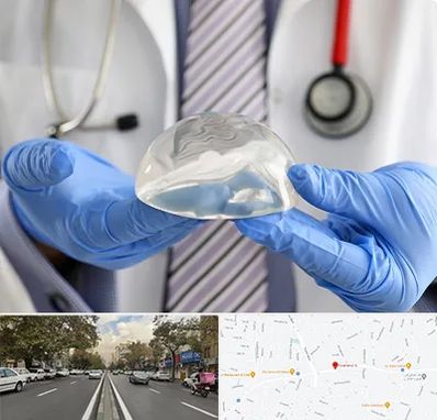 ماموپلاستی در دولت