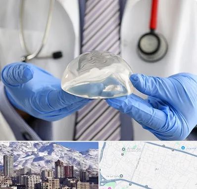 ماموپلاستی در ازگل