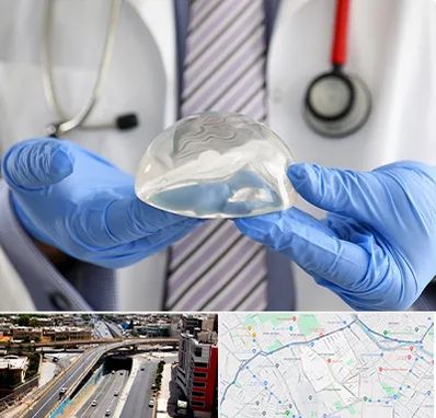 ماموپلاستی در ستارخان شیراز