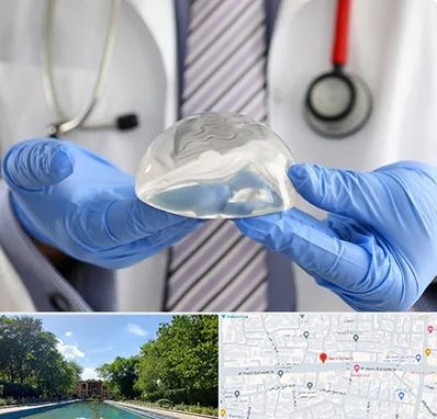 ماموپلاستی در هشت بهشت اصفهان