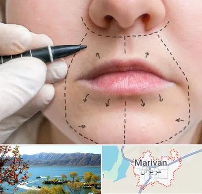 عمل سانترال لب در مریوان