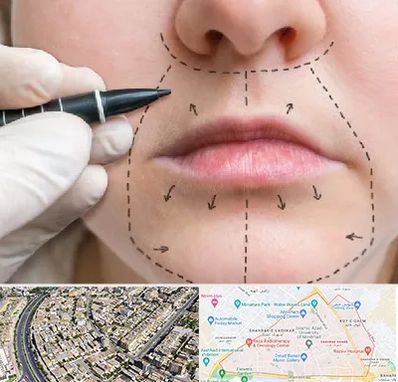 عمل سانترال لب در شهرک غرب مشهد