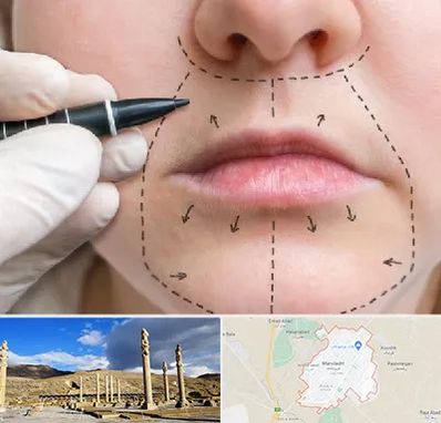 عمل سانترال لب در مرودشت