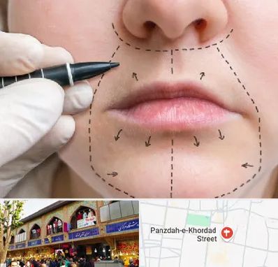 عمل سانترال لب در 15 خرداد