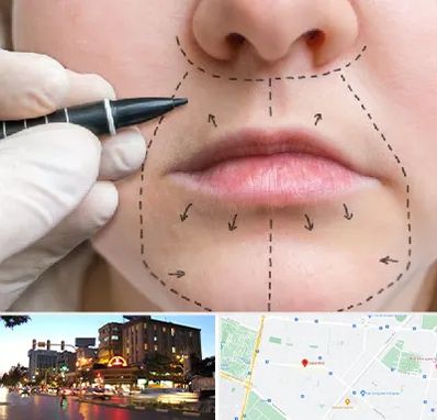 عمل سانترال لب در بلوار سجاد مشهد