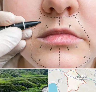 عمل سانترال لب در گچساران
