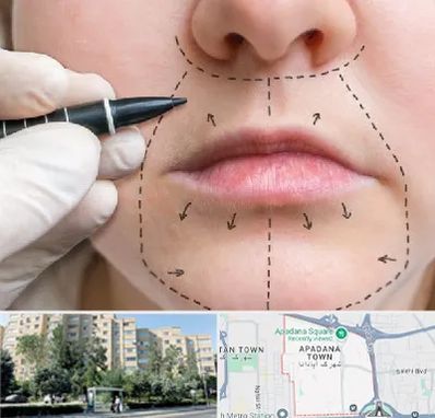 عمل سانترال لب در آپادانا