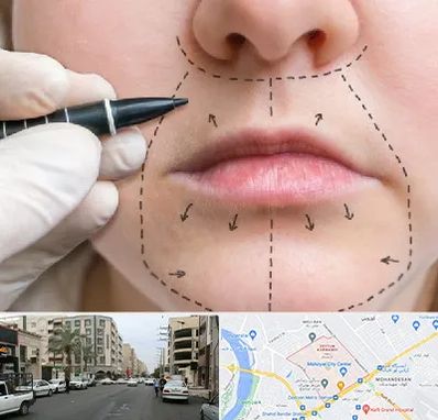 عمل سانترال لب در زیتون کارمندی اهواز