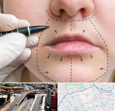 عمل سانترال لب در ستارخان شیراز