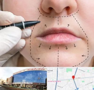 عمل سانترال لب در نصف راه تبریز