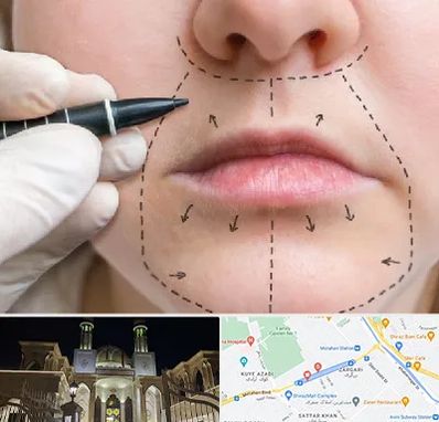 عمل سانترال لب در زرگری شیراز