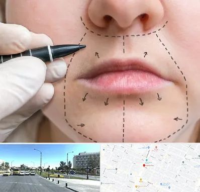 عمل سانترال لب در بلوار کلاهدوز مشهد