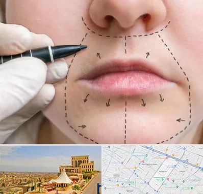 عمل سانترال لب در هاشمیه مشهد