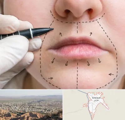 عمل سانترال لب در اسفراین
