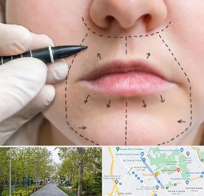 عمل سانترال لب در قدوسی غربی شیراز